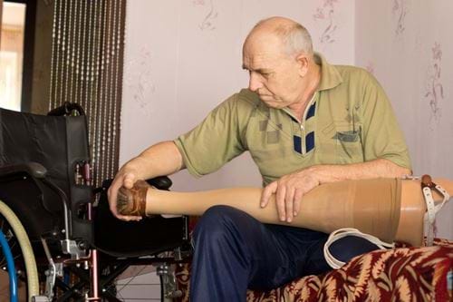 Prosthetics