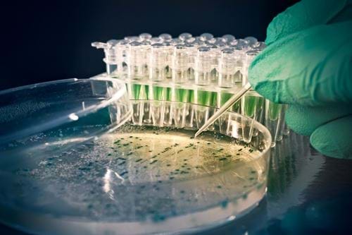 Bacteria in petri dish