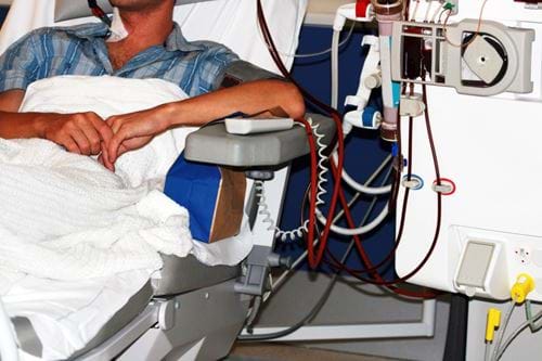 Dialysis machine