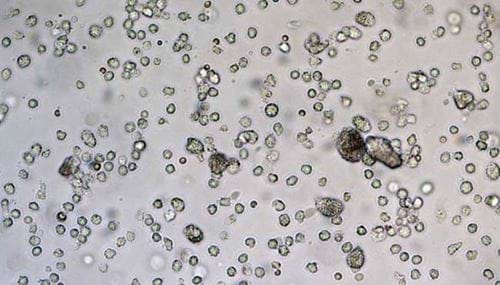 Immune system’s dendritic cells